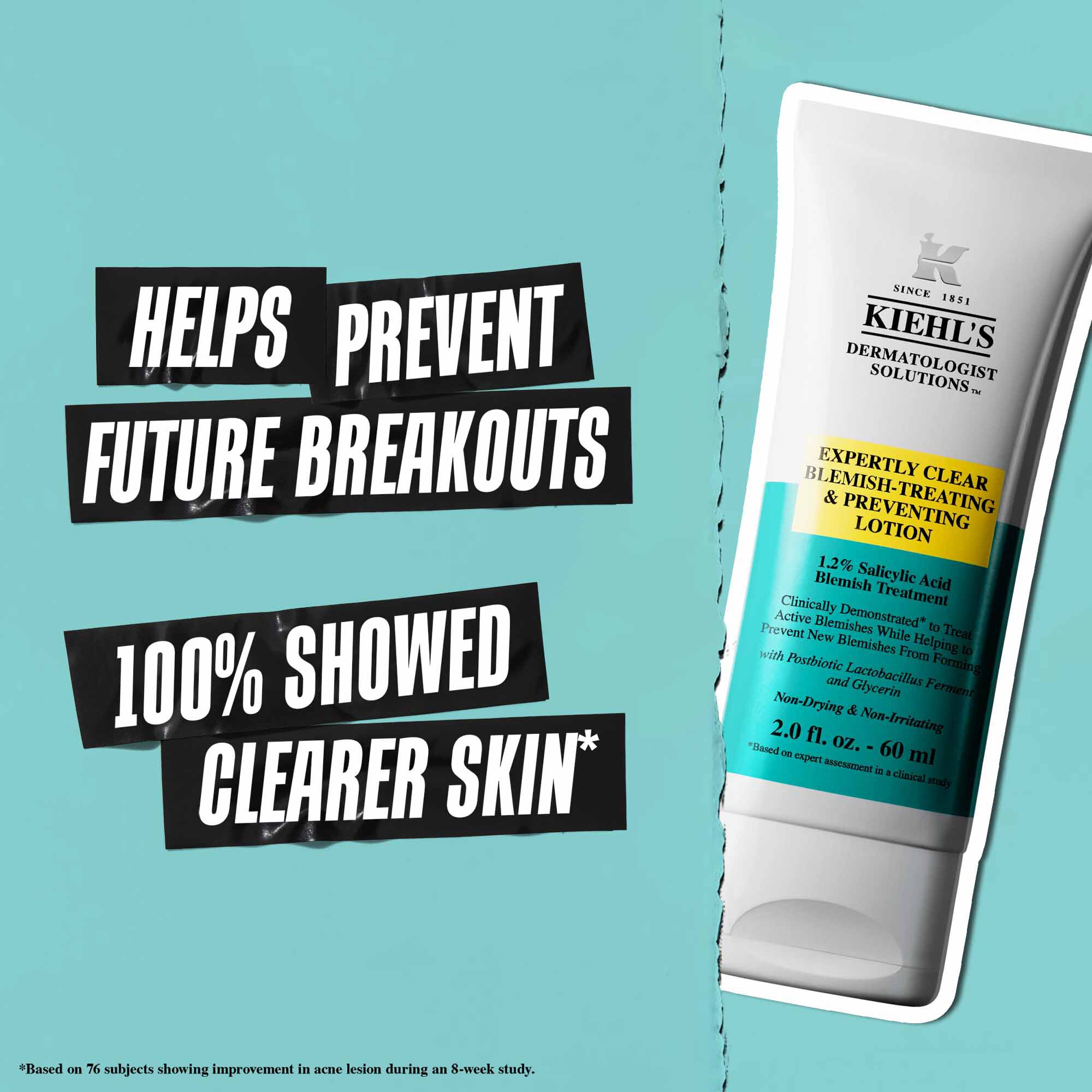 A tube of Expertly Clear Blemish-Treating & Preventing Lotion against a blue background with text reading "Helps Prevent Future Breakouts" and "100% Showed Clearer Skin."
