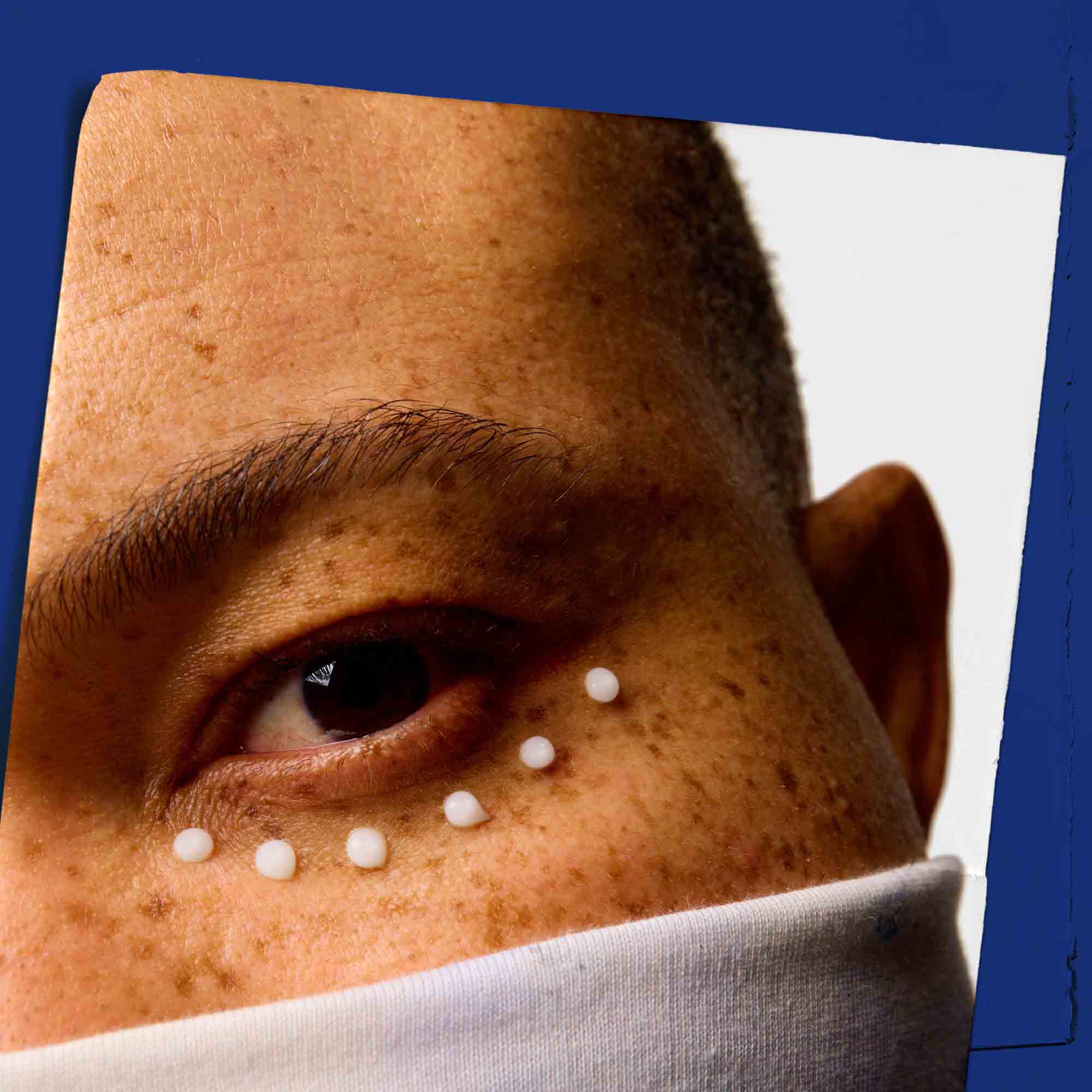 Close-up of skin around the eye area dotted with Facial Fuel Eye Fuel.