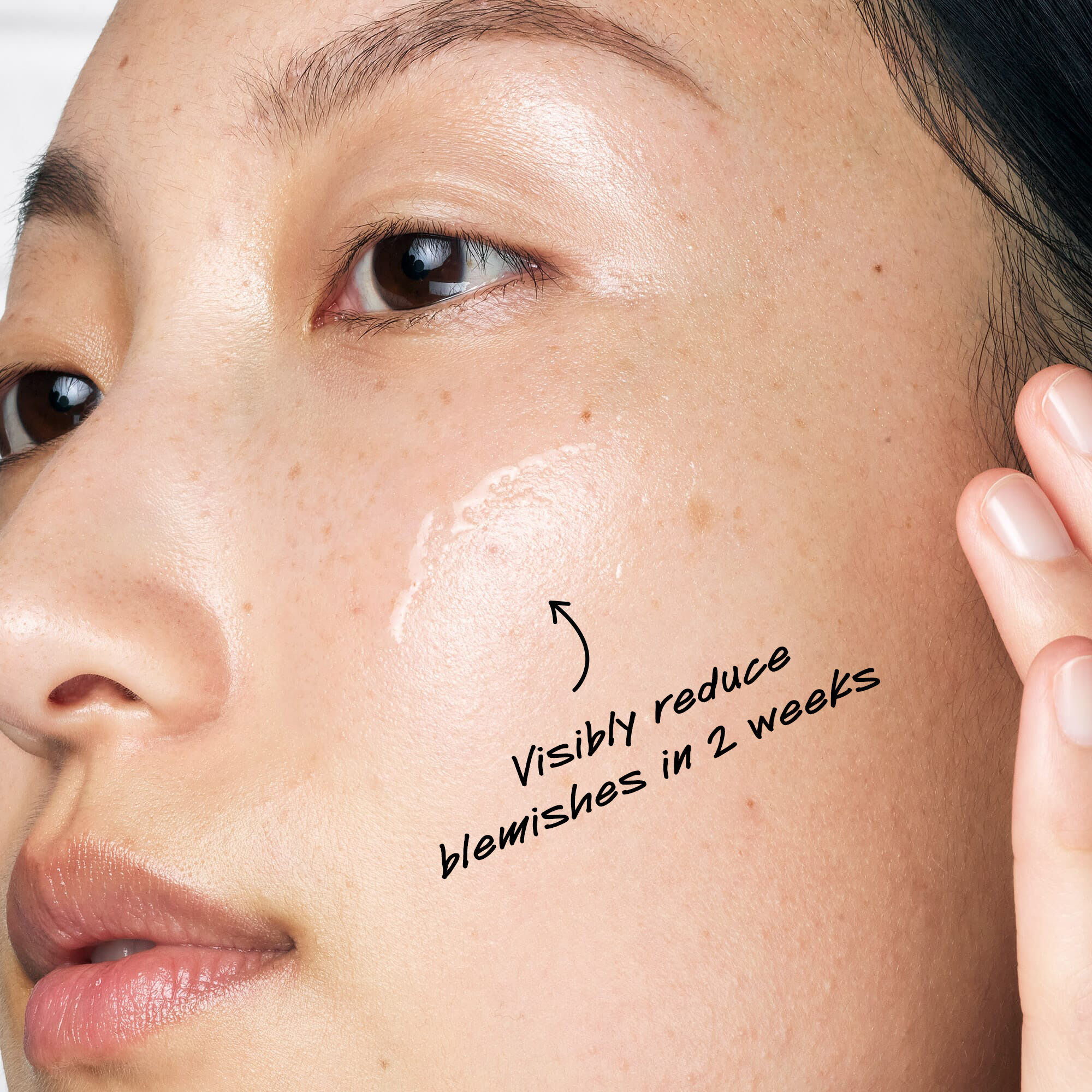 Imperfection Experts