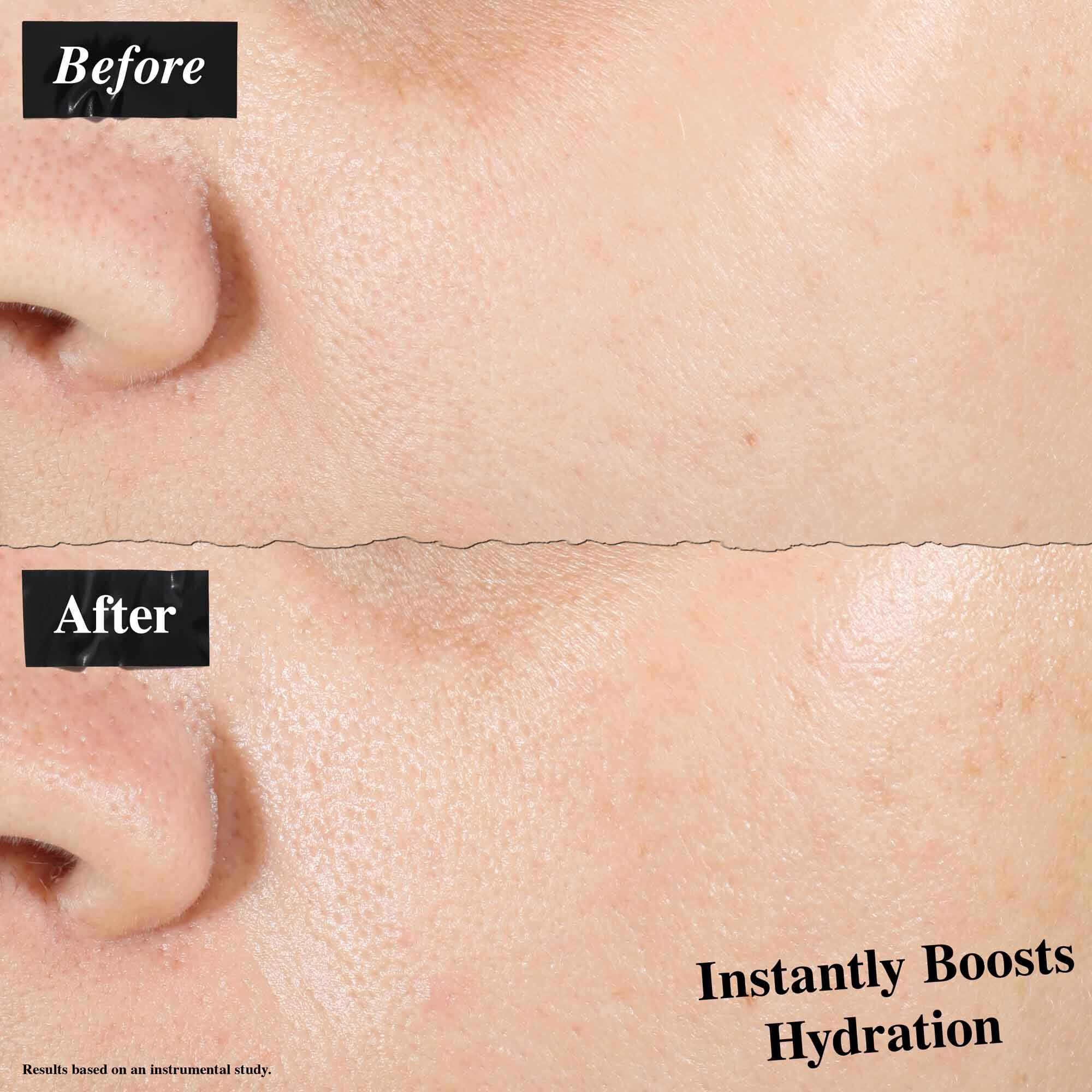 A before-and-after comparison showing skin treated with Ultra Pure 1.5% Hyaluronic Acid Serum. The "before" image shows dry skin, while the "after" image shows instantly boosted hydration.