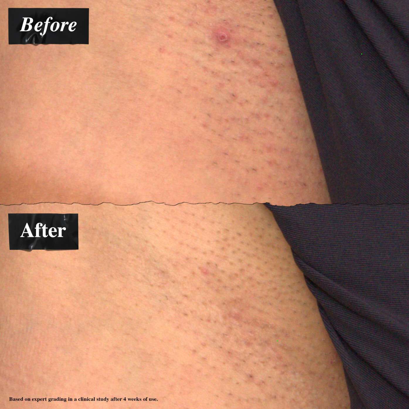 Ingrown Hair and Tone-Correcting Intimate Drops ingredients – AHA Blend, Astaxanthin, Jojoba Oil