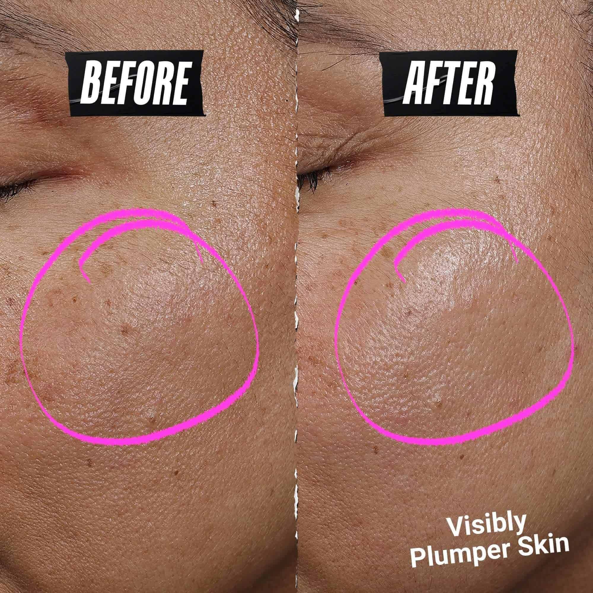 1cc* CollaShot Plump Serum