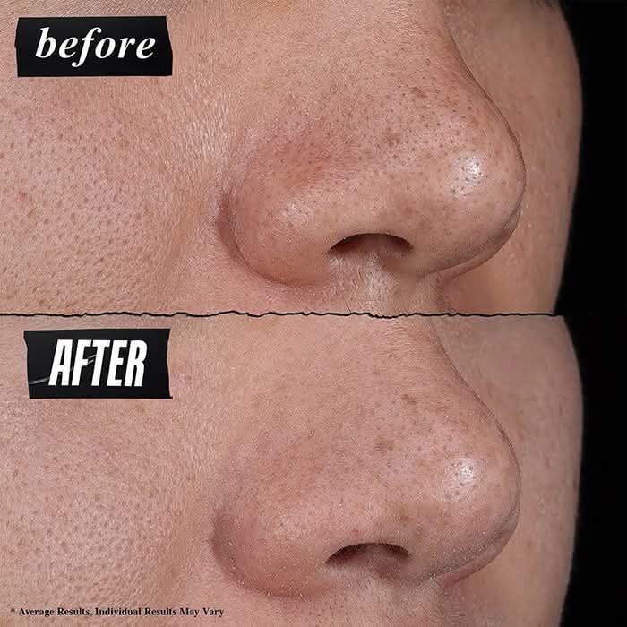 Before & After photo - Kiehl's Rare Earth Deep Pore Cleansing Masque visibly reduces pores