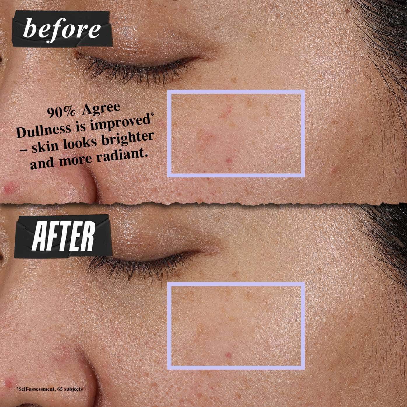 Clearly Corrective™ Clarity-Activating Soothing Emulsion