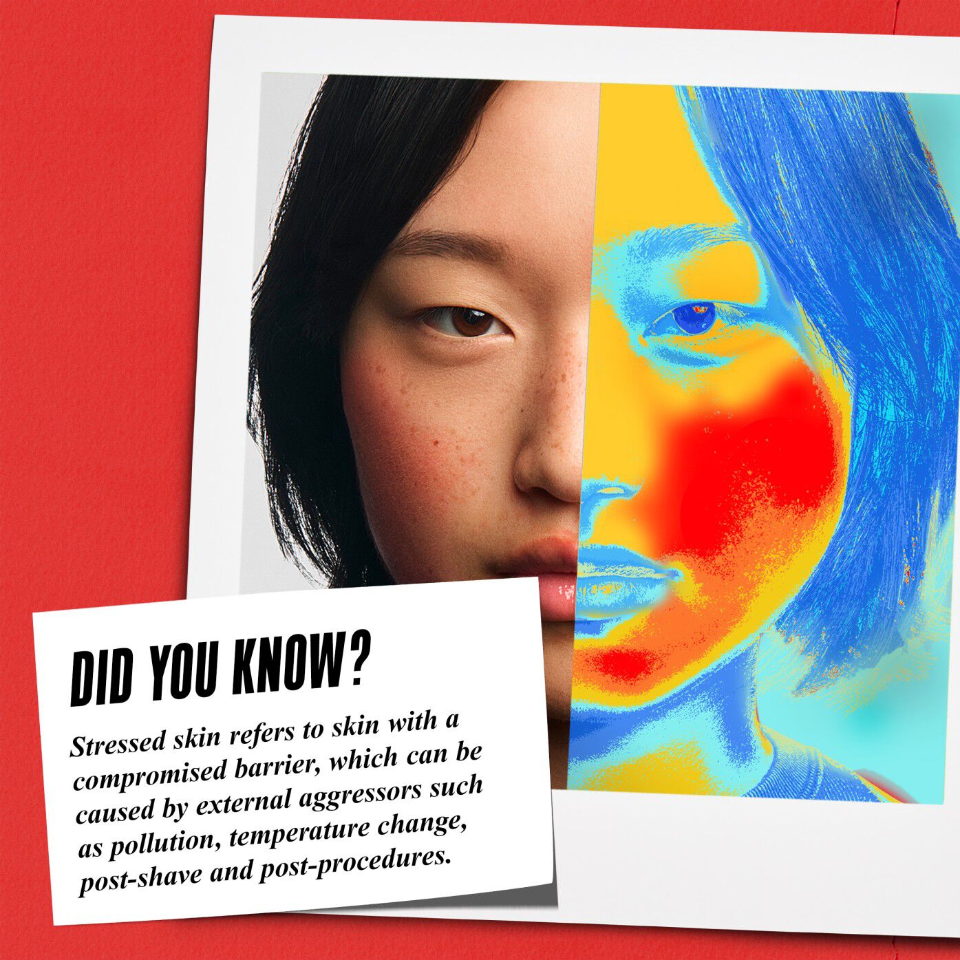 DID YOU KNOW? Stressed skin refers to skin with a compromised barrier, which can be caused by external aggressors such as pollution, temperature change, post-shave and post-procedures." Image shows a thermal face scan illustrating irritation.