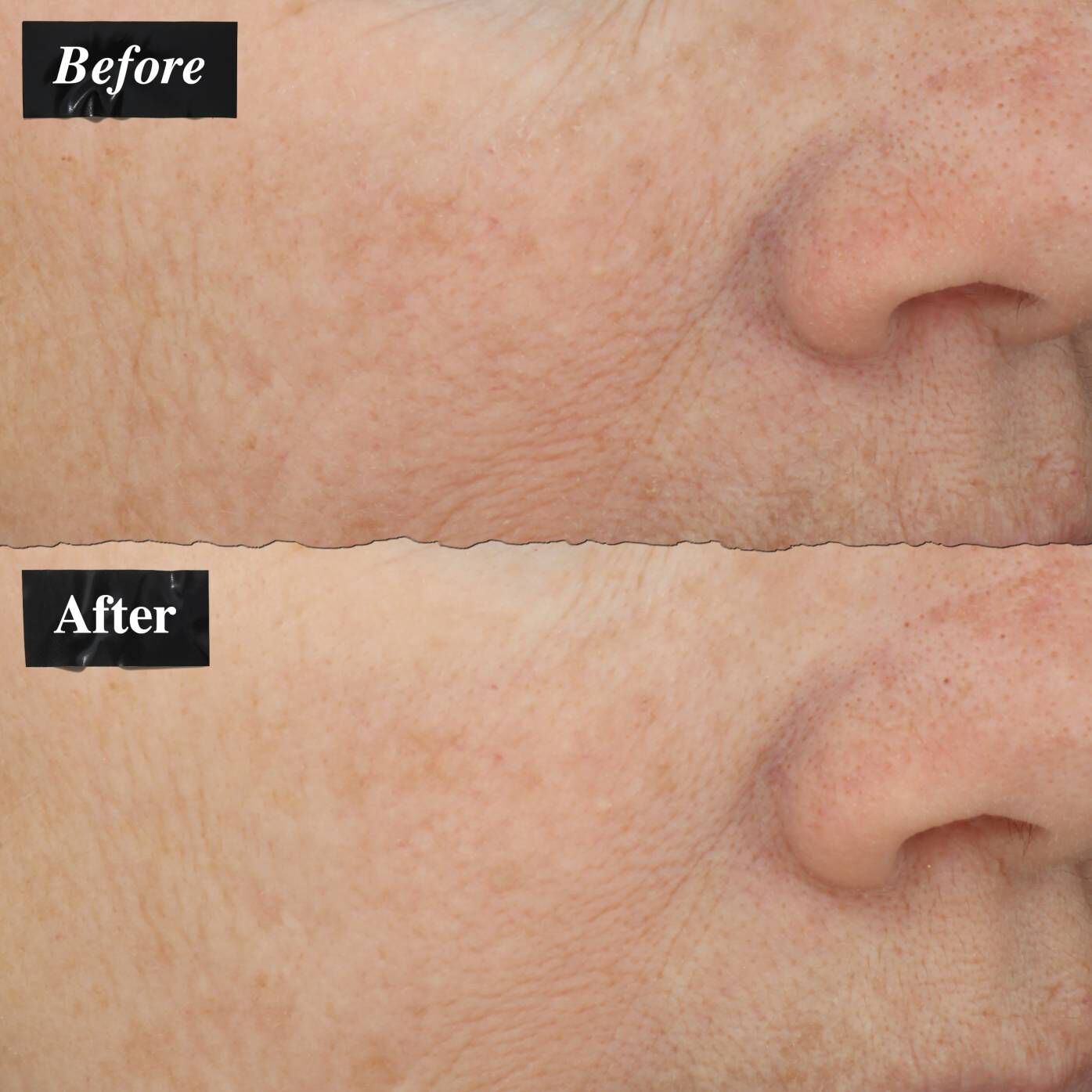 A before-and-after image comparison showing improvement in skin redness after using Powerful-Strength Line-Reducing Concentrate.