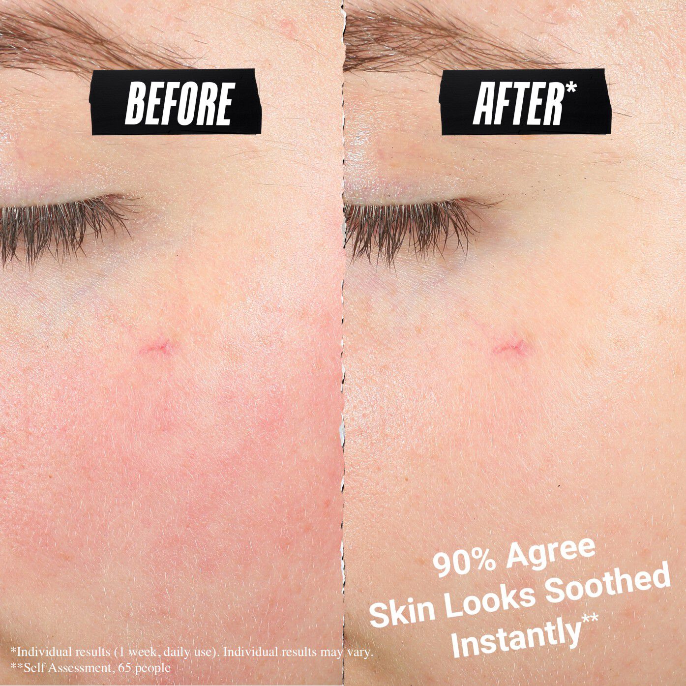 Side-by-side before and after comparison showing a reduction in skin redness. Text reads "90% Agree Skin Looks Soothed Instantly."