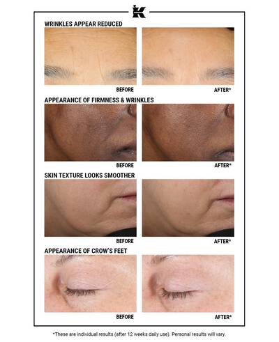 Alt text: A comparison image showing the results of a skincare treatment. Four sections display "before" and "after" photos demonstrating reduced wrinkles, improved firmness and texture, smoother skin, and decreased appearance of crow's feet. The results highlight visible improvements after 12 weeks of daily use.