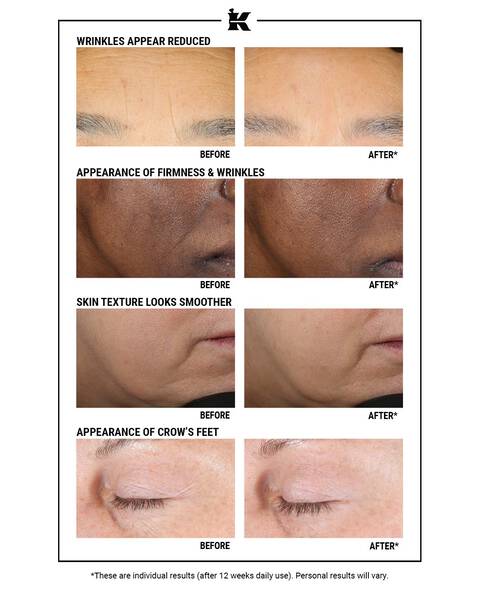 Before and After Retinol Serum