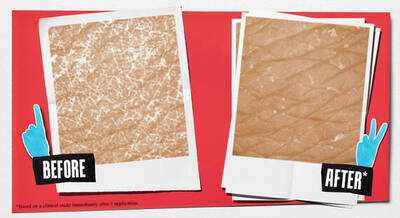 A split image showing two polaroid-style photos labeled "Before" and "After." The "Before" photo displays rough, textured skin, while the "After" photo shows smoother skin.