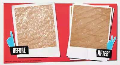 A split image showing two polaroid-style photos labeled "Before" and "After." The "Before" photo displays rough, textured skin, while the "After" photo shows smoother skin.